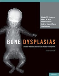 Papel Bone Dysplasias, An Atlas Of Genetic Disorders Of Skeletal Development