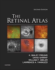 E-book The Retinal Atlas