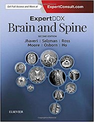 Papel Expert Ddx Brain And Spine