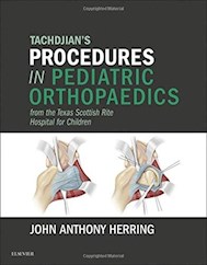 Papel Tachdjian'S Procedures In Pediatric Orthopaedics