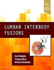 Papel Lumbar Interbody Fusions