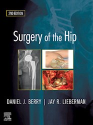 E-book Surgery Of The Hip E-Book