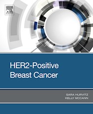 E-book Her2-Positive Breast Cancer