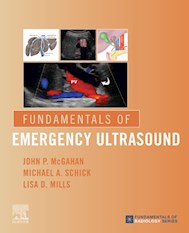 E-book Fundamentals Of Emergency Ultrasound