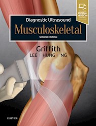 E-book Diagnostic Ultrasound: Musculoskeletal