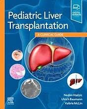 Papel Pediatric Liver Transplantation