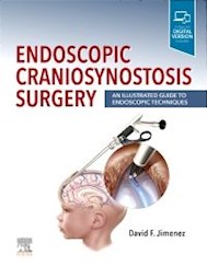 Papel Endoscopic Craniosynostosis Surgery