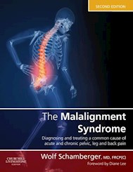 E-book The Malalignment Syndrome