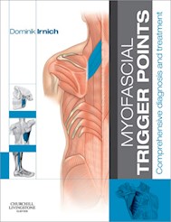 E-book Myofascial Trigger Points