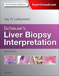 Papel Scheuer'S Liver Biopsy Interpretation Ed.9