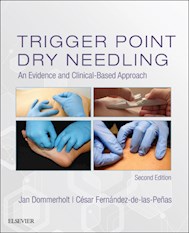 E-book Trigger Point Dry Needling