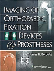 Papel Imaging Of Orthopedic Fixation Devices & Prostheses