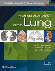 Papel High-Resolution Ct Of The Lung