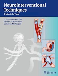 Papel Neurointerventional Techniques