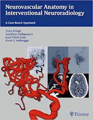 Papel Neurovascular Anatomy In Interventional Neuroradiology