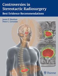 Papel Controversies In Stereotactic Radiosurgery