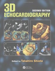 Papel 3D Echocardiography