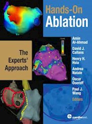 Papel Hands-On Ablation: The Experts' Approach