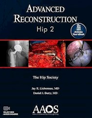 Papel Advanced Reconstruction: Hip 2