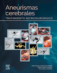 E-book Aneurismas Cerebrales