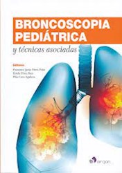 Papel Broncoscopia Pediatrica Y Tecnicas Asociadas