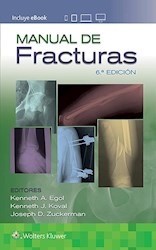 Papel Manual De Fracturas Ed.6