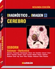 Papel Cerebro, Diagnostico Por Imagen