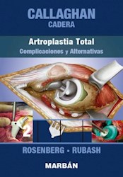 Papel Callaghan Cadera T2. Artroplastia Total