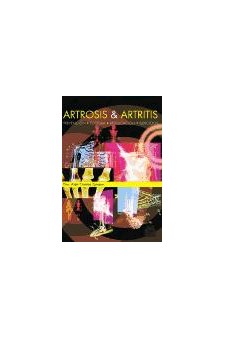 Papel Artrosis & Artritis. Prevencion, Postura, Reeducacion Y Ejercicios