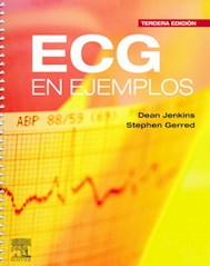 Papel Ecg En Ejemplos Ed.3