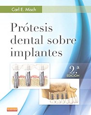 Papel Prótesis Dental Sobre Implantes Ed.2