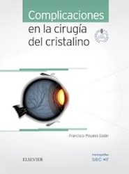 Papel Complicaciones En La Cirugía Del Cristalino