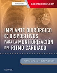 Papel+Digital Implante Quirúrgico De Dispositivos Para La Monitorización Del Ritmo Cardíaco