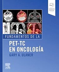 Papel Fundamentos De La Pet-Tc En Oncología