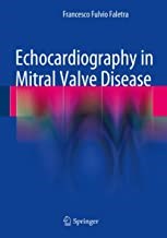 Papel Echocardiography In Mitral Valve Disease