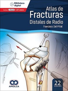 Papel Atlas de Fracturas Distales de Radio