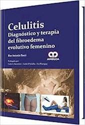 Papel Celulitis