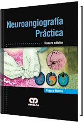 Papel Neuroangiografía Práctica