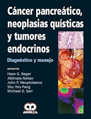 Papel Cancer Pancreatico, Neoplasias Quisticas Y Tumores Endocrino