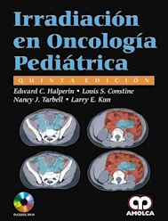 Papel Irradiación En Oncología Pedriática