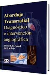 Papel Abordaje Transradial Diagnóstico E Intervención Angiográfica