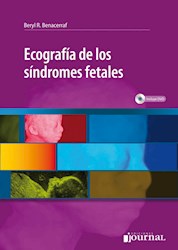 Papel Ecografía De Los Síndromes Fetales