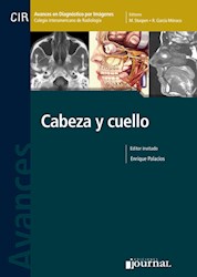 Papel Avances En Diagnóstico Por Imágenes: Cabeza Y Cuello