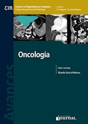 Papel Avances En Diagnóstico Por Imágenes: Oncología