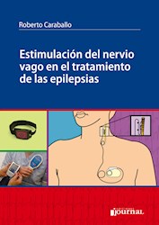 Papel Estimulación Del Nervio Vago En El Tratamiento De Las Epilepsias