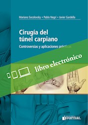 E-Book Cirugía Del Túnel Carpiano (Ebook)