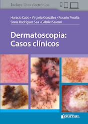 Papel+Digital Dermatoscopia: Casos Clínicos