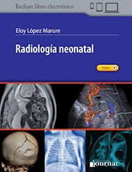 E-Book Radiología Neonatal (Ebook)