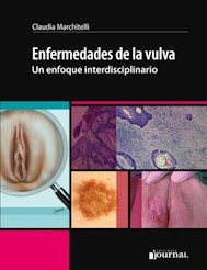 E-Book Enfermedades De La Vulva (Ebook)