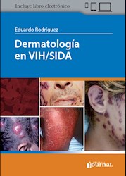 Papel Dermatología En Vih/Sida